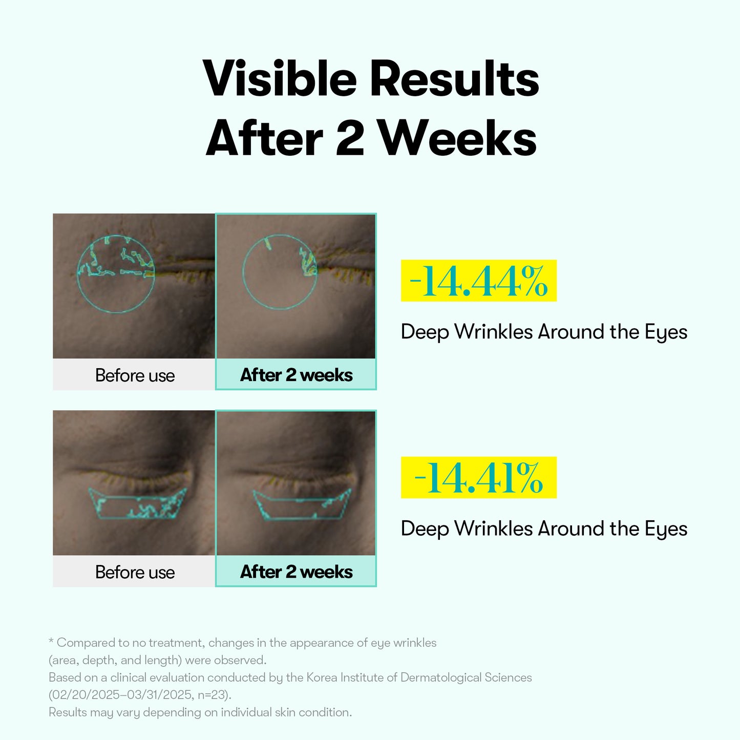 PDRN Reedle Shot Firming Eye Cream