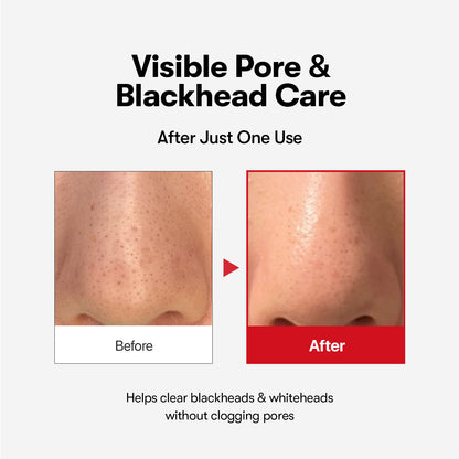 Azelaic Acid Cleansing Oil