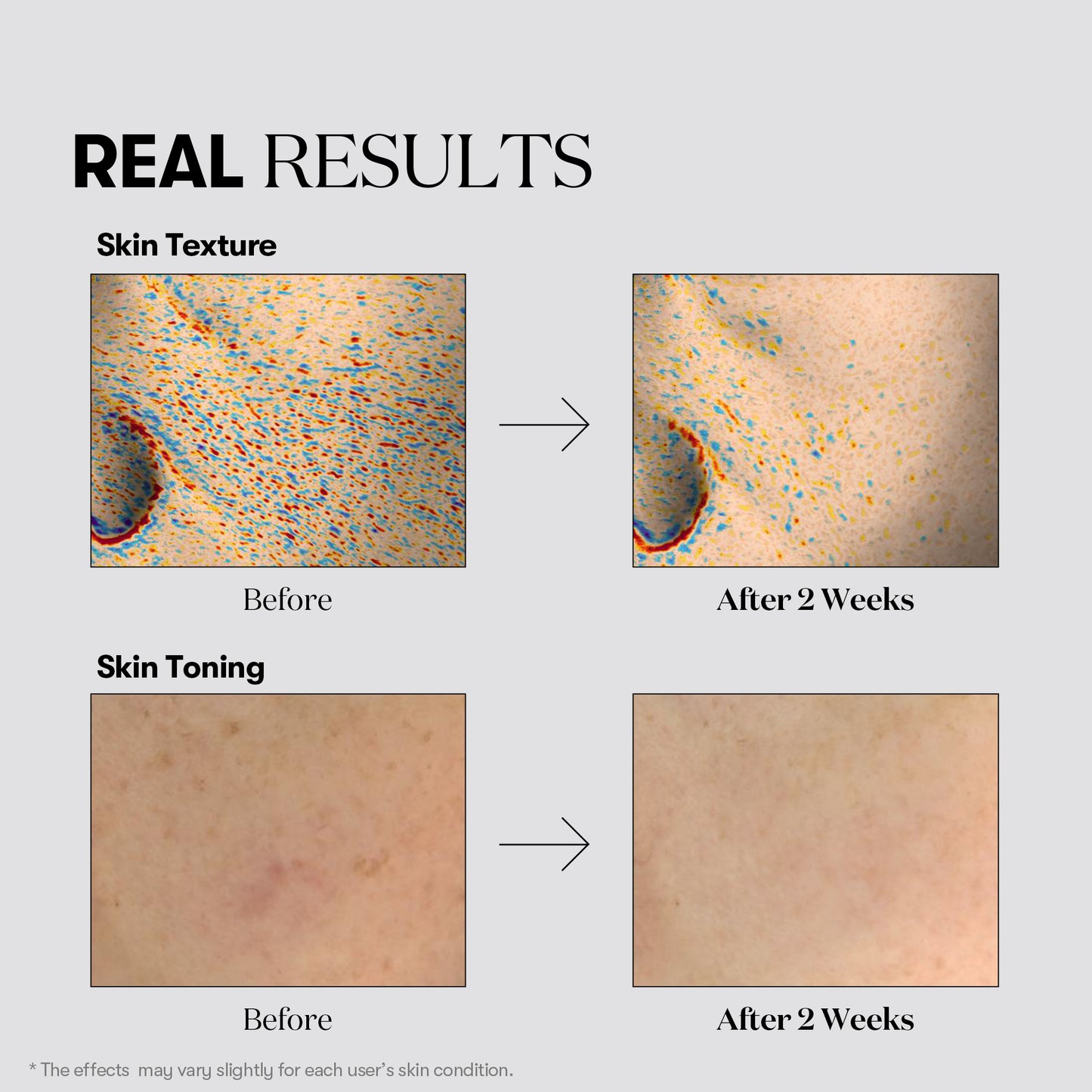 Tx-toning Daily Mask