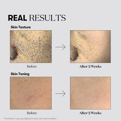 Tx-toning Daily Mask